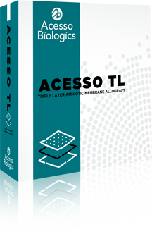 Acesso TL